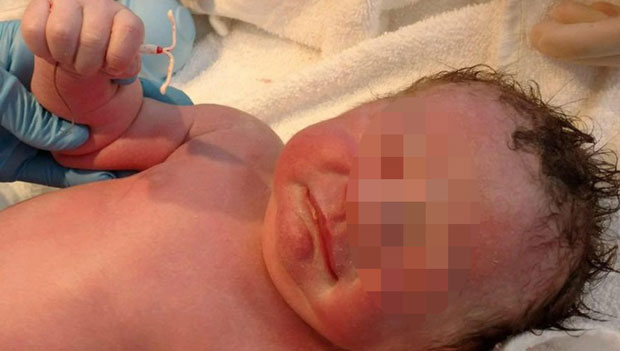 Доказ да је живот јачи од науке: Тек рођена беба у руци држи мајчину спиралу против зачећа (ФОТО)